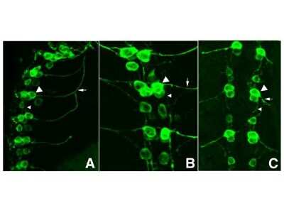 Tissue: Drosophila melanogaster late stage embryonic central nervous system. Fixation: 0.5% PFA. Antigen retrieval: not required. Primary antibody: anti-GFP antibody at a 1:1,000 for 1 h at RT. Secondary antibody: AlexaFluor 488 conjugated anti-Goat antibody at 1:300 for 45 min at RT. Panel A: shows a lateral view (ventral left). Panels B and C: shows ventral views of whole mount embryos at 63x magnification (plus 2x digital zoom). In all panels, anterior is up. Staining: tau-GFP cell bodies (large arrowhead) and axons of motorneurons (arrow) and interneurons (small arrowhead) as green fluorescent signal.